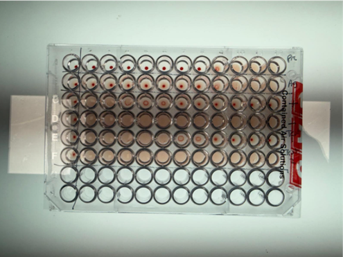 Louping -ill Blood Test Set Up In The Laboratory