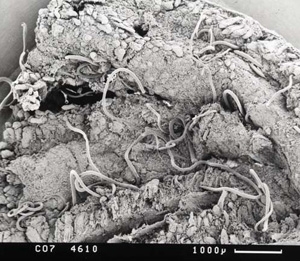 Strongyle worms