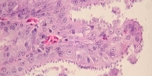 Red grouse and cryptosporidiosis