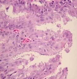 Photomicrograph showing Cryptosporidium infection